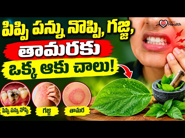 Home Remedies | పిప్పి పన్ను నొప్పి, గజ్జి, తామరకు ఒక్క ఆకు చాలు! కుప్పింటాకు Benefits | ToneHealth