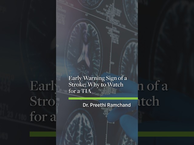 Early Warning Sign of a Stroke: Why to Watch for a TIA