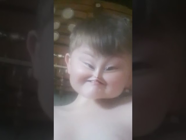 xd