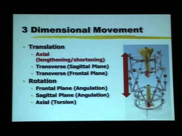 Six Axis Correction - Hexapod