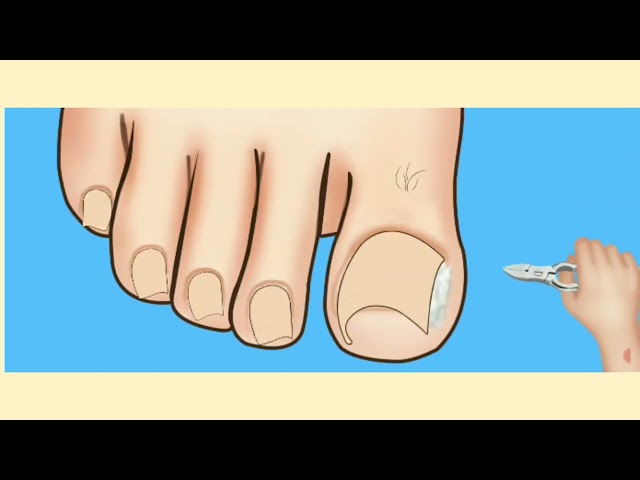 foot spa treatment #treatment #asmr #games