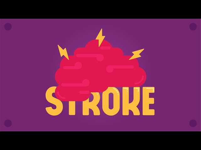 What is Stroke?