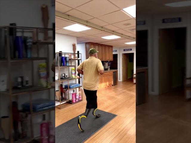 Bilateral Amputee Running with Prosthetic Running Blades