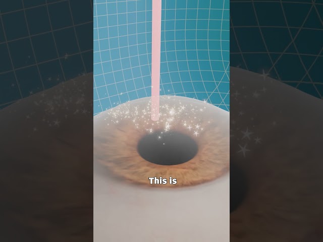 How Lasik Surgery Works ๐ค