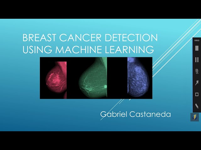 breast cancer detection using machine learning by Gabriel Castaneda