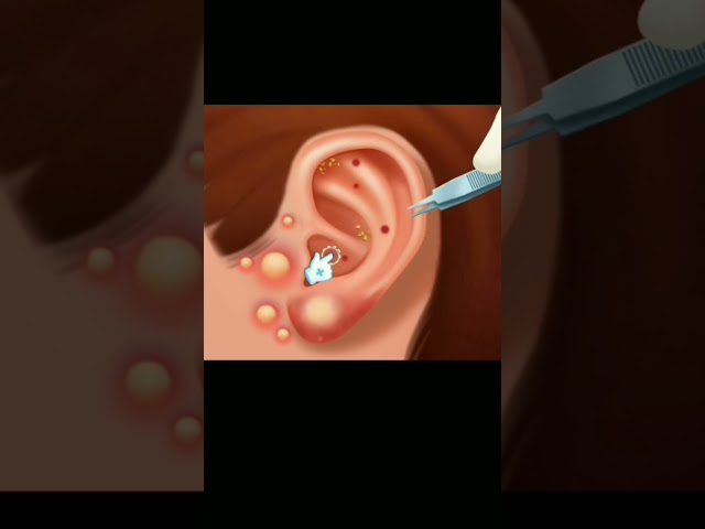 ear treatment 😮💥 #shorts#games #asmr #viral #treatment