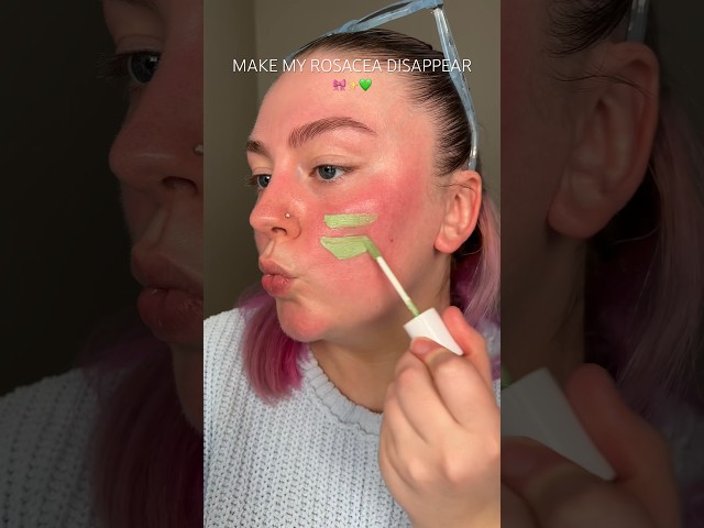 MAKE MY ROSACEA DISAPPEAR💚✨🎀 #makeup #rosacea #colorcorrection #redness