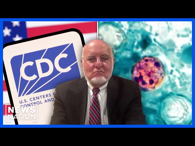 Ex-CDC director on cyclosporiasis outbreak: Symptoms can take weeks | Elizabeth Vargas Reports
