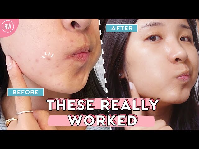 🙌 Top 4 Skincare Secrets That Changed Our Skin in 2020 🙌