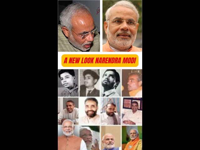 Narendra Modi Hair Transplant??. Kab Hua Tha???