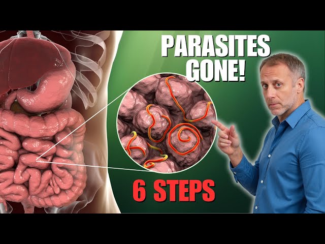 6 Steps to Eliminate Parasites Naturally
