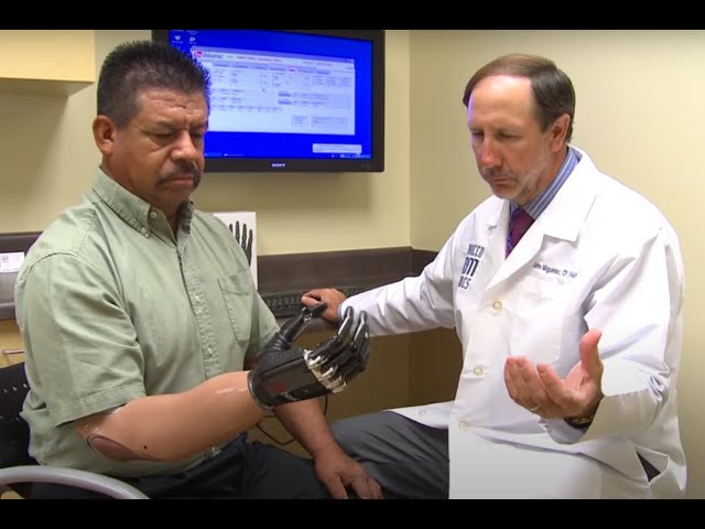 International Expert on Bionic Arms and Hands Works With Advanced Technologies