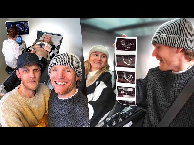 DE 20 WEKEN ECHO EN MILAN GAAT MEE! | baby vlog #7