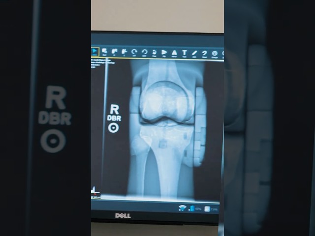 Radiologic Technology at SPC!