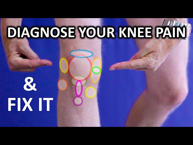 Every Knee Pain EXPLAINED in 11 Minutes... & Their Fixes!