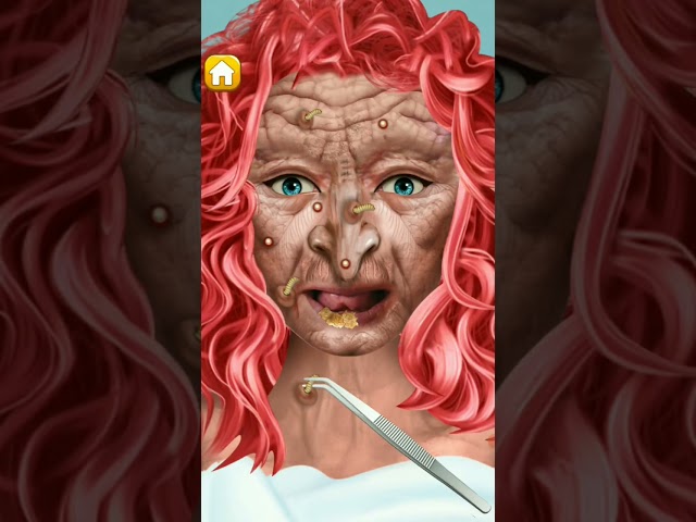 treatment 🔥💥#shorts #treatment #games #asmr