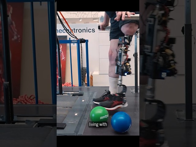 Tissue-integrated bionic knee prosthesis restores natural leg function