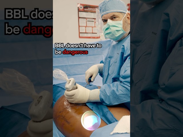 BBL Ultrasound Technique #bbl