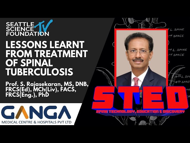Lessons Learnt from Treatment of Spinal Tuberculosis - Prof. S. Rajasekaran, MS, DNB, PhD