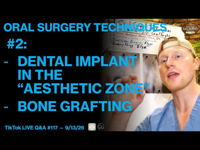 Dental Implant In The “Aesthetic Zone,” Bone Grafting | Oral Surgery Techniques #2 w/ Dr. Gallagher