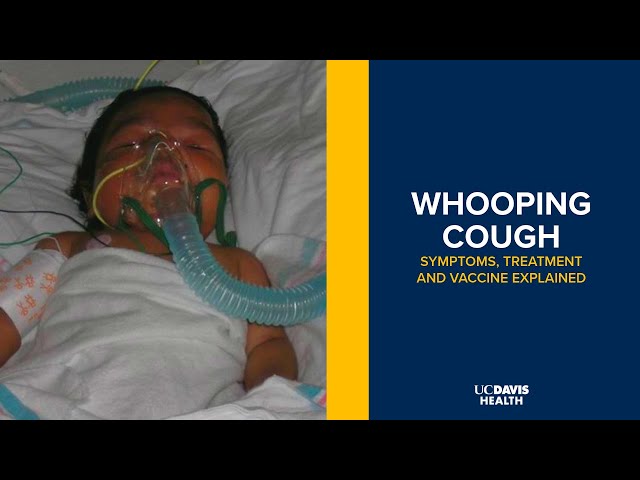 Whooping Cough (Pertussis) Symptoms, Treatment and Vaccine Explained | UC Davis Children's Hospital