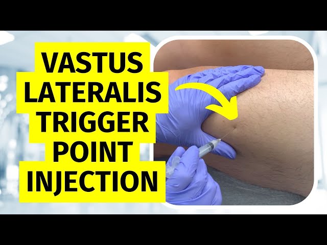 Trigger Point Injection Vastus Lateralis Technique