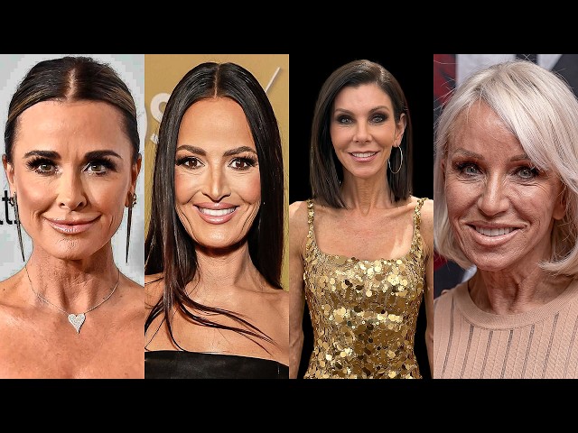 21 Real Housewives Suffering From Ozempic Face in 2026 | Before & After Photos