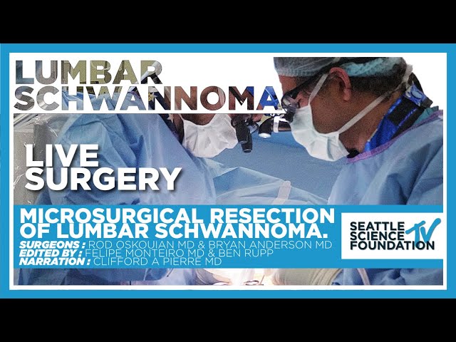 Microsurgical Resection of Lumbar Schwannoma - Rod J Oskouian, Jr. M.D.