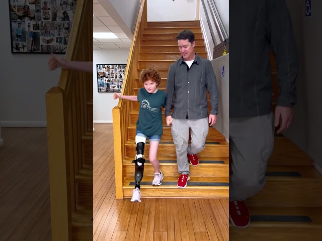 Leah Practices Stairs with Her Rotationplasty Prosthesis