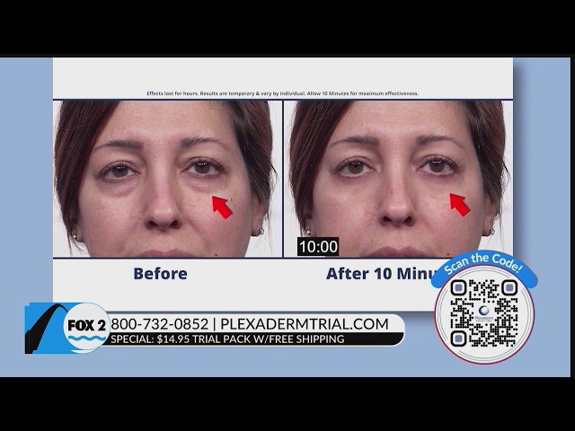 Take the Plexaderm 10-minute Challenge for Glowing Skin!