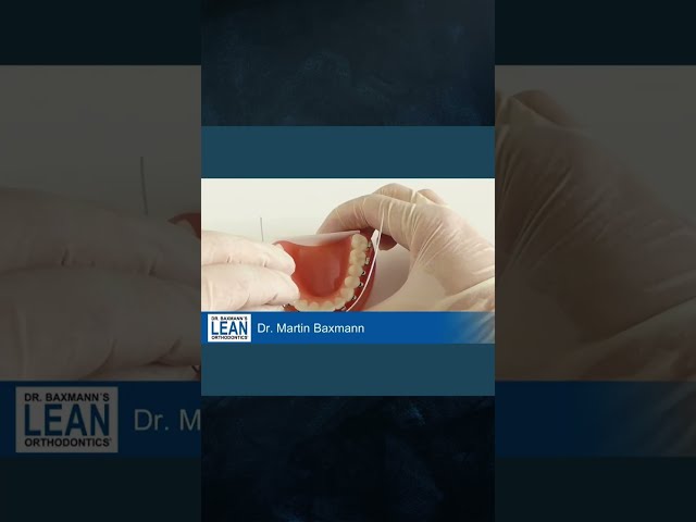 How to derotate teeth