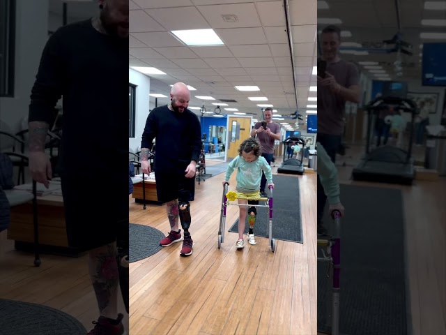 Belle's Rotationplasty Experience: Insightful Lessons from a Seasoned Amputee