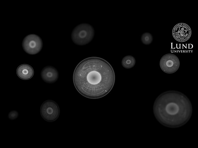 Amniotic fluid is a rich source of stem cells – that can now be harvested