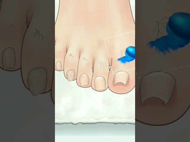 foot treatment 😮💥 #shorts #treatment #games #asmr