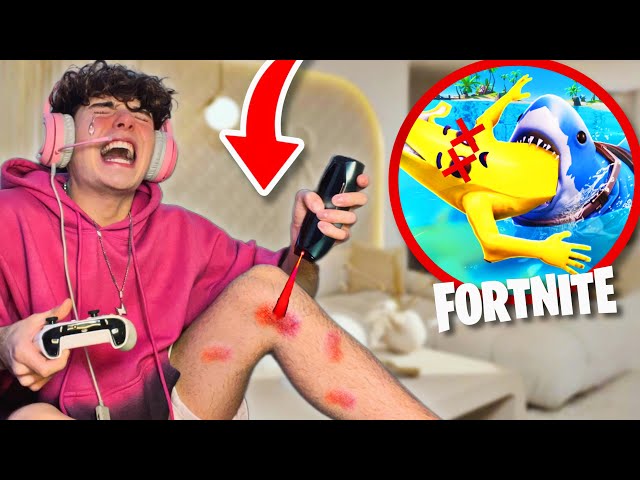 LASER HAIR REMOVAL Every Time I Die In Fortnite!
