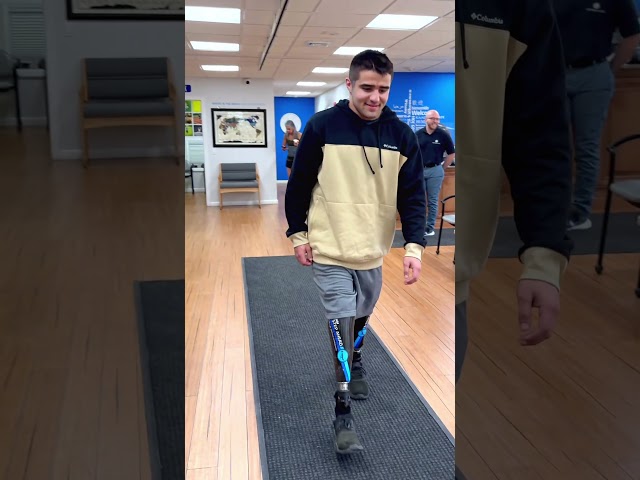Bilateral BK Amputee Deven's Prosthetic Journey
