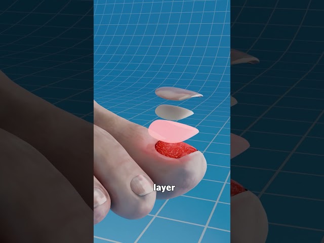 What Happens When You Lose A Nail ๐ฑ