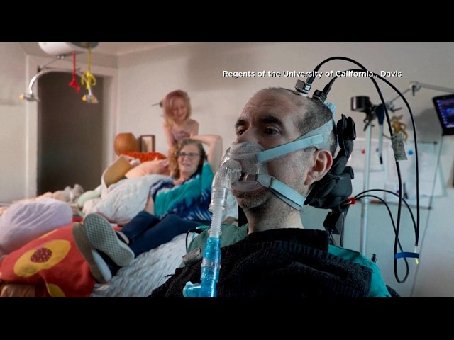 AI helps man with ALS speak again
