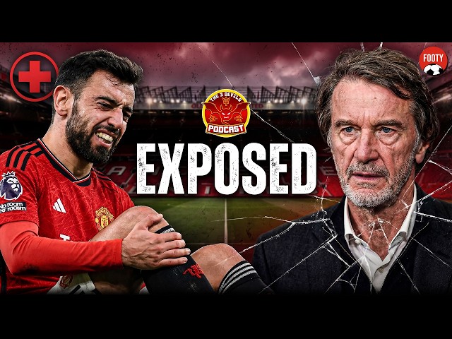 Why Man United Were ALWAYS One Injury Away From Disaster