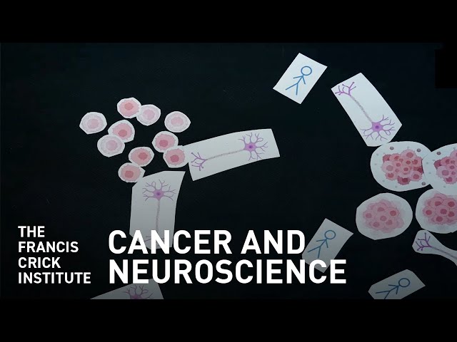 Cancer and Neuroscience – an Introduction to Leanne Li and the Cancer-Neuroscience Lab