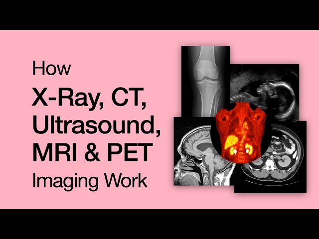 Why X-ray, CT, Ultrasound, MRI & PET Imaging Work