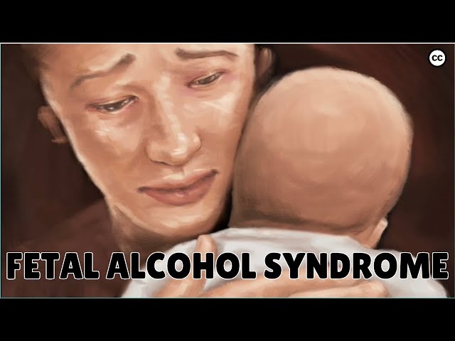 Fetal Alcohol Spectrum Disorders [FASD]