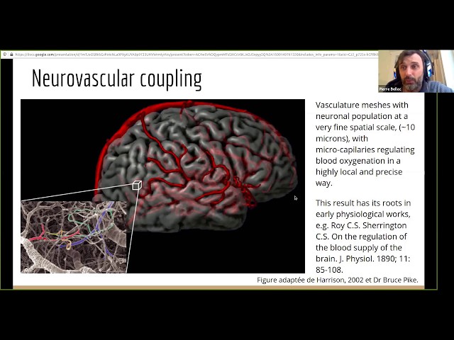 Introduction to functional MRI connectivity