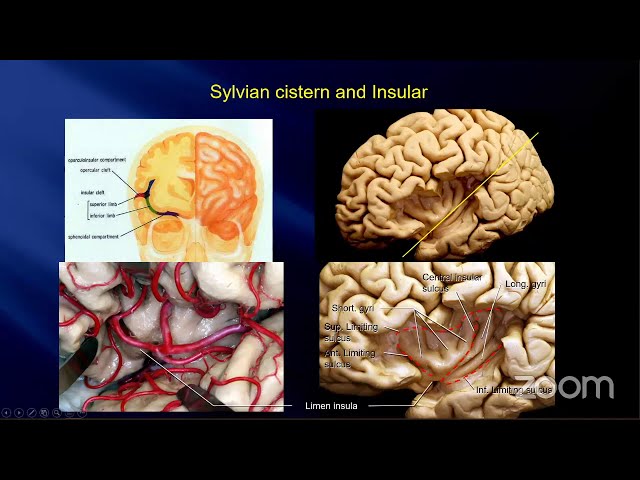 The Battlefield of Aneurysm Surgery:The Surgical Anatomy of the Arachnoid Membranes & Cisterns-Inoue