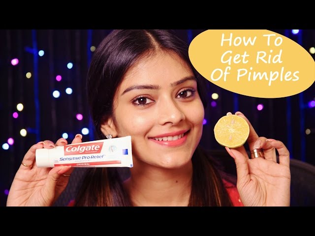 Learn How To Get Rid Of Pimples  | Acne | Remove Acne | Overnight |  Make Up Videos | Foxy
