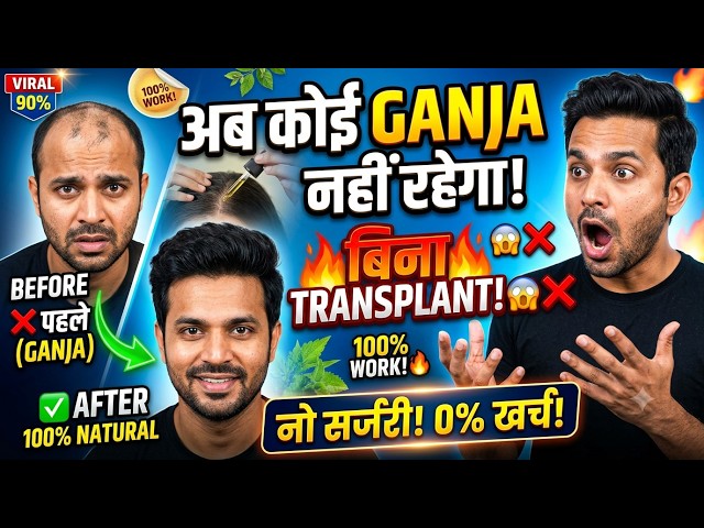 अब कोई GANJA नहीं रहेगा! 😱 बिना Transplant उगाएं नए बाल! | 100% Natural Hair Regrowth! 🌿🧑‍🦱