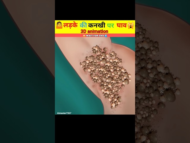 #trending #3danimation 🤷लड़के की कांखे पर घाव हो गया 🙀#shortsfeed #viral #shots
