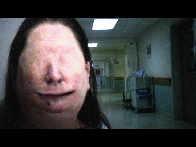 MEDICAL HORRORS