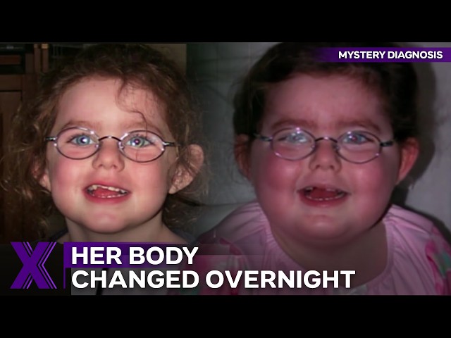 Doctors Thought The Mother Was Crazy | Mystery Diagnosis