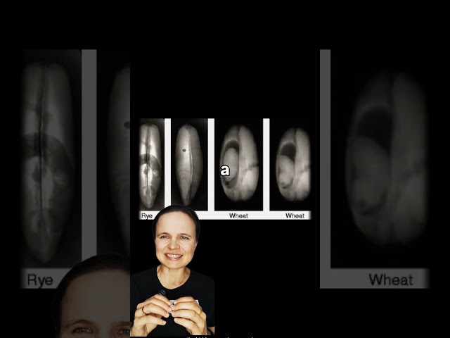 x-ray + AI for grains